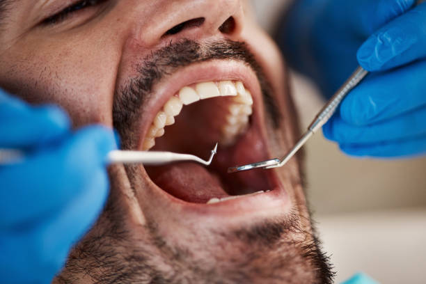 Best Same-Day Dentist Appointment  in Broadmoor, CA